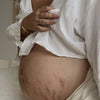 Love Lines Emollient Stretch Mark Balm - Lev Logisk