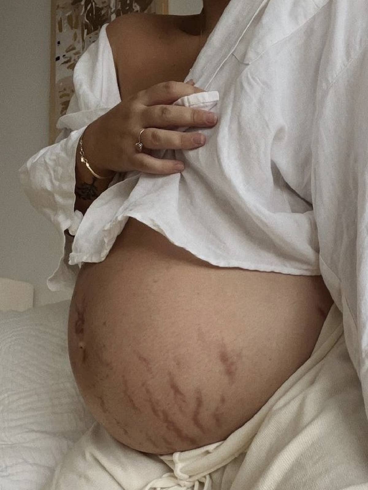 Love Lines Emollient Stretch Mark Balm - Lev Logisk